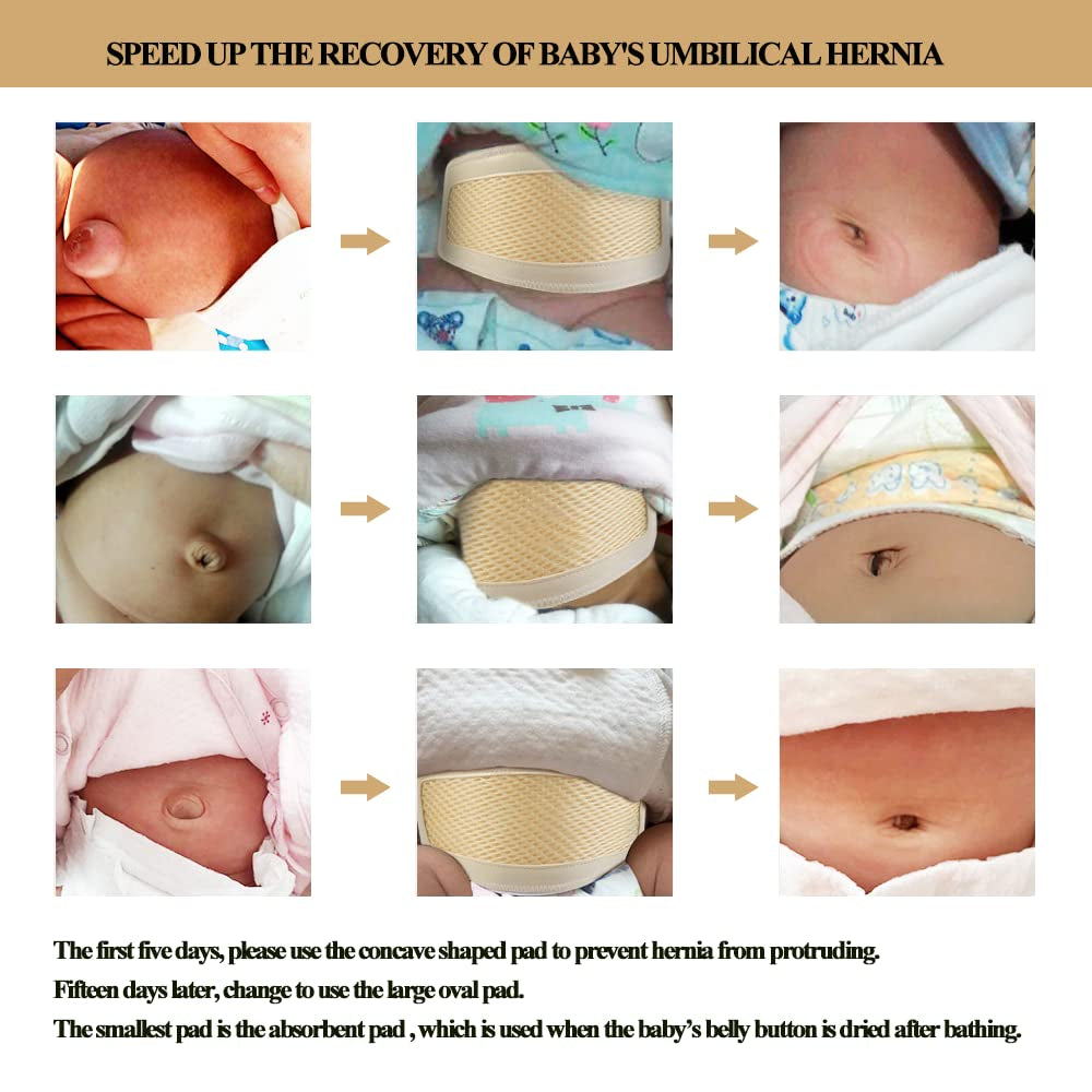 Umbilical Hernia Belt Baby/Infant Belly Button Band Wrap Truss Abdominal Binder for Children Kids Support Adjustable Navel Band Newborn Umbilical Cord 15-20 Inch